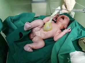 小孩引产的吃瓜视频